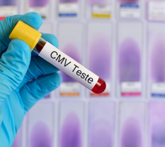 CMV – Citomegalovírus